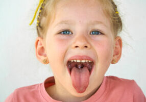 Natural ways to shrink tonsils